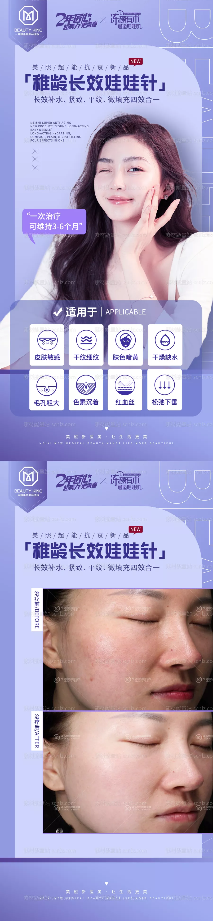素材能量站-娃娃针适用范围医美海报
