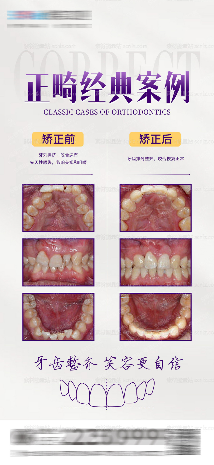 素材能量站-医美口腔正畸案例对比海报