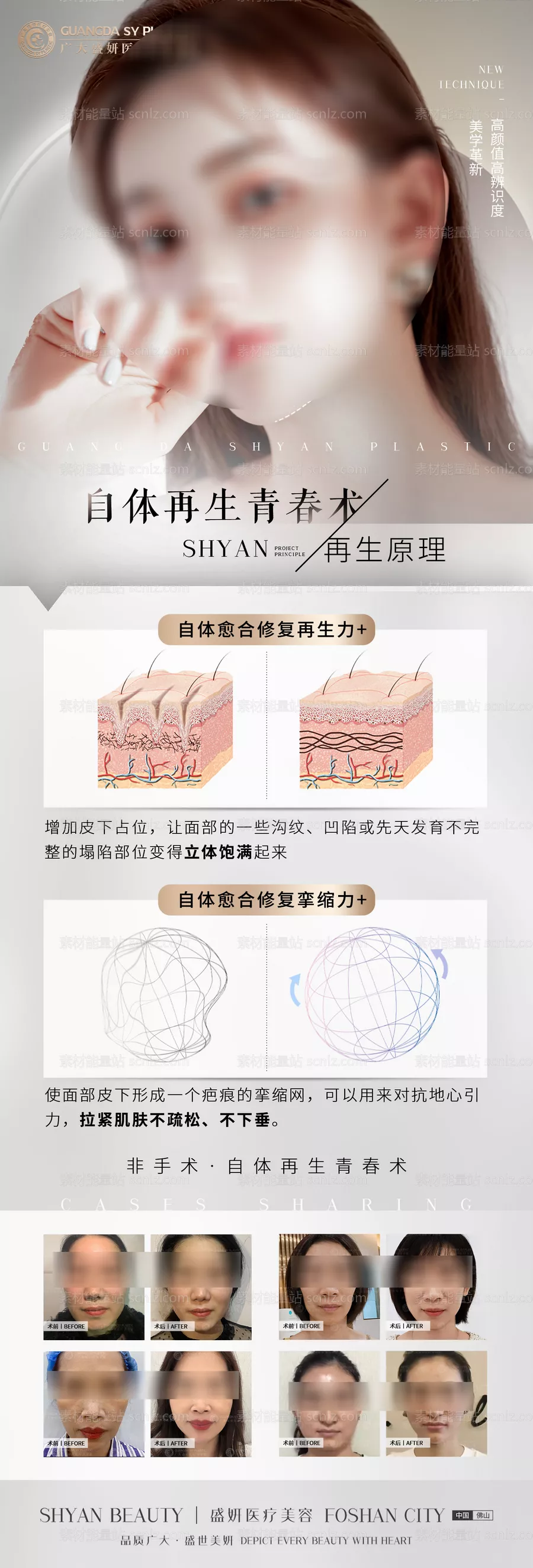 素材能量站-青春再生术长图