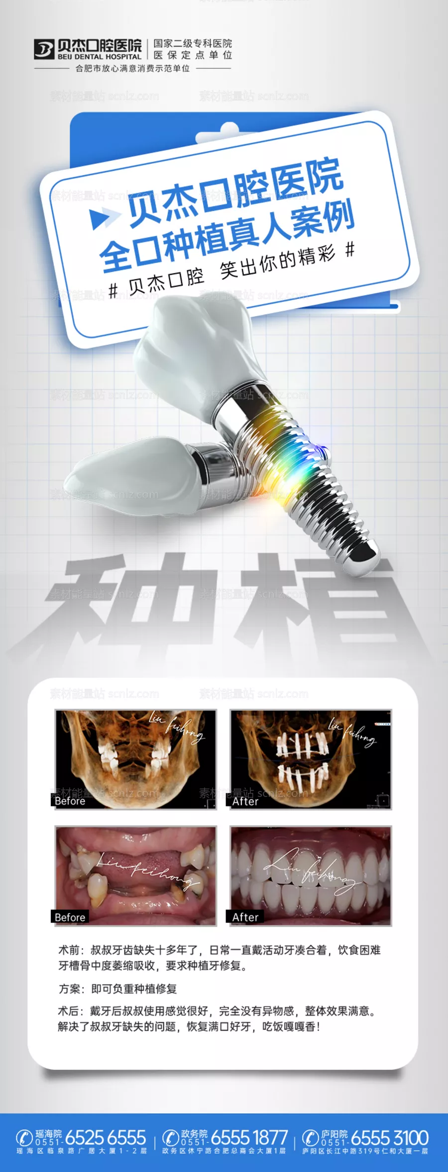 素材能量站-口腔种植牙案例