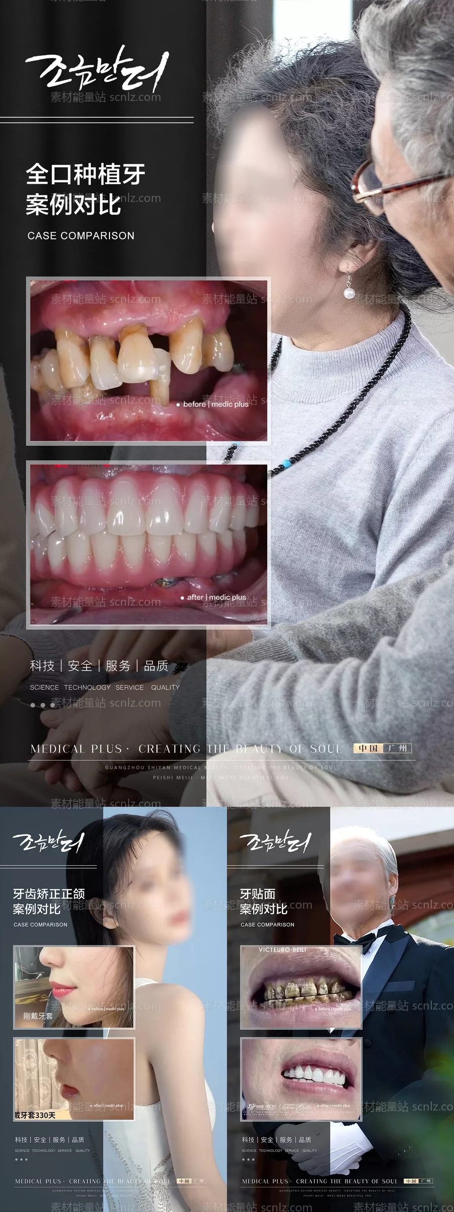 素材能量站-口腔案例