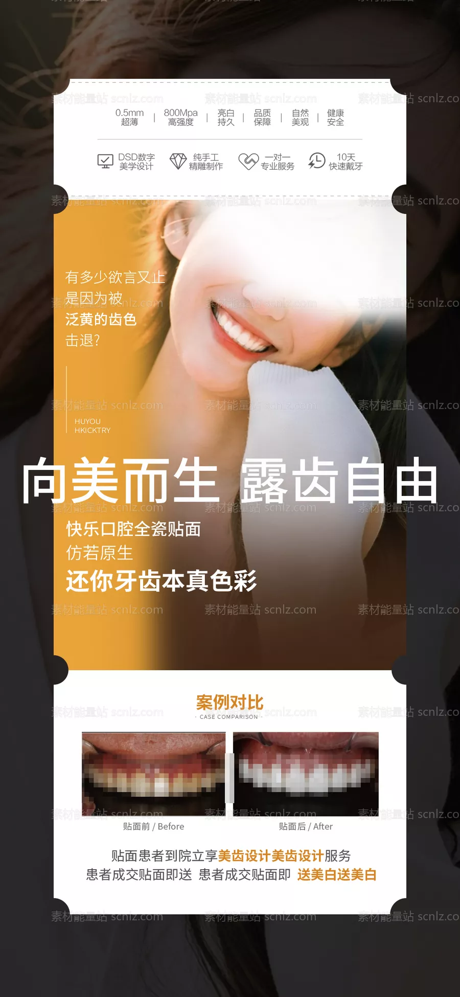 素材能量站-口腔贴面产品