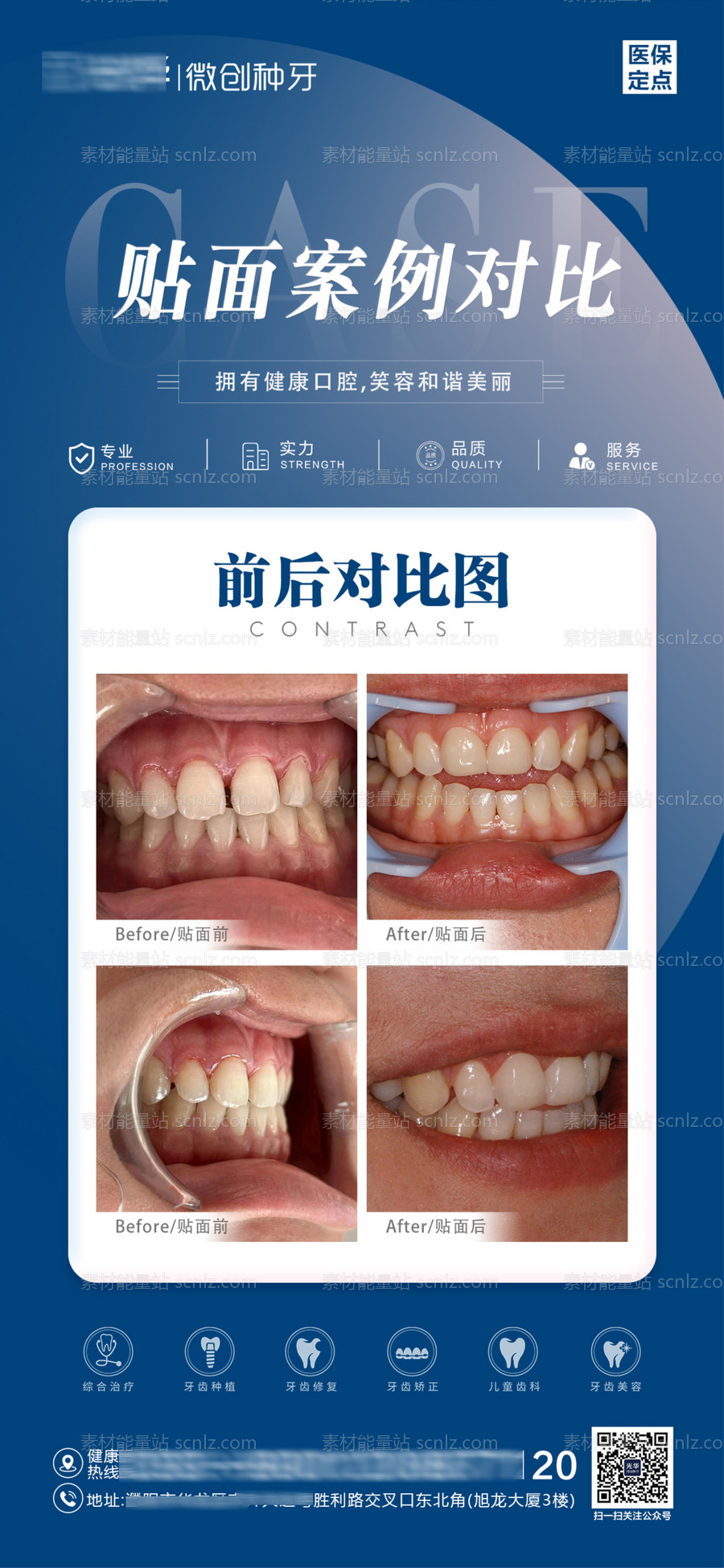 素材能量站-贴面案例对比图