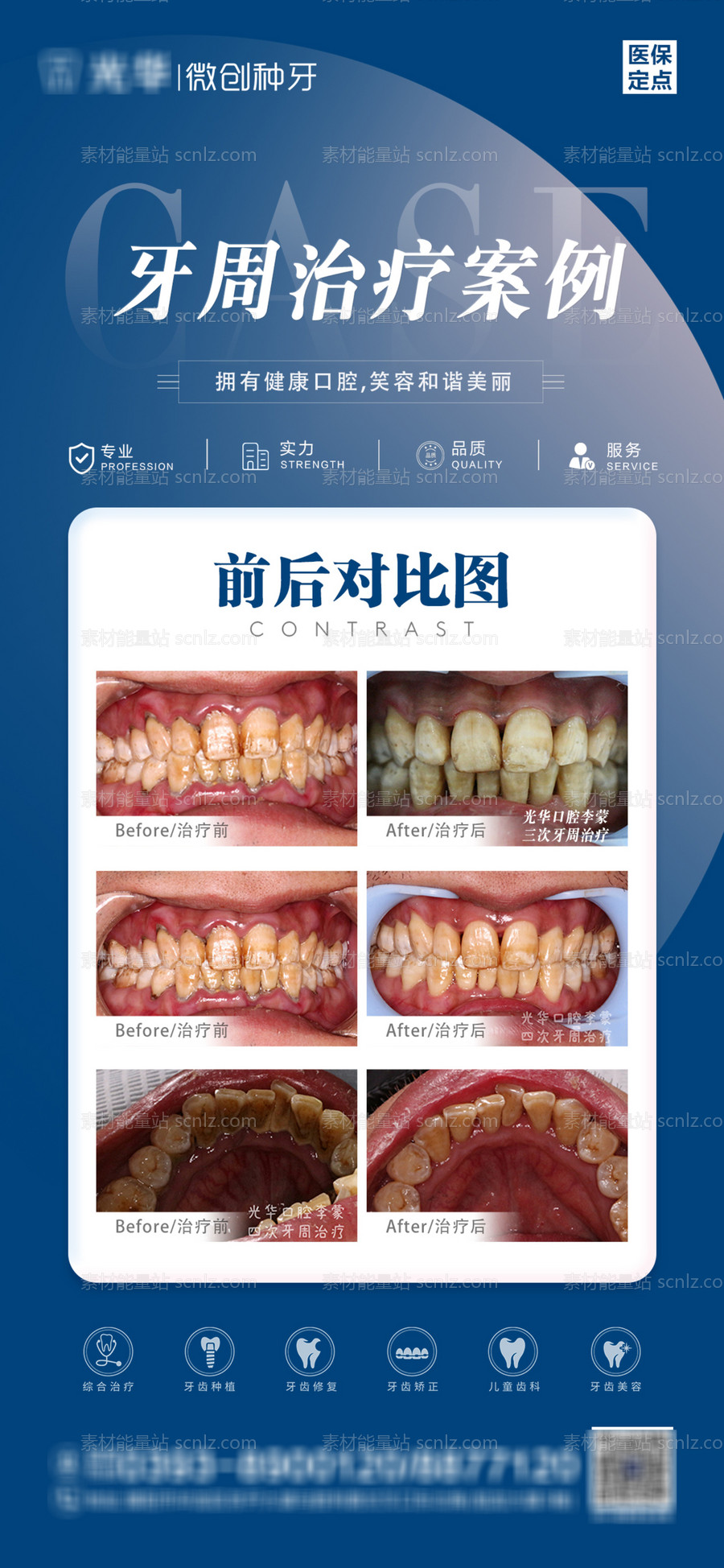 素材能量站-牙周案例对比图