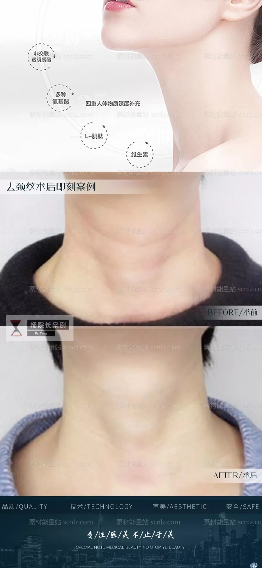 素材能量站-颈纹