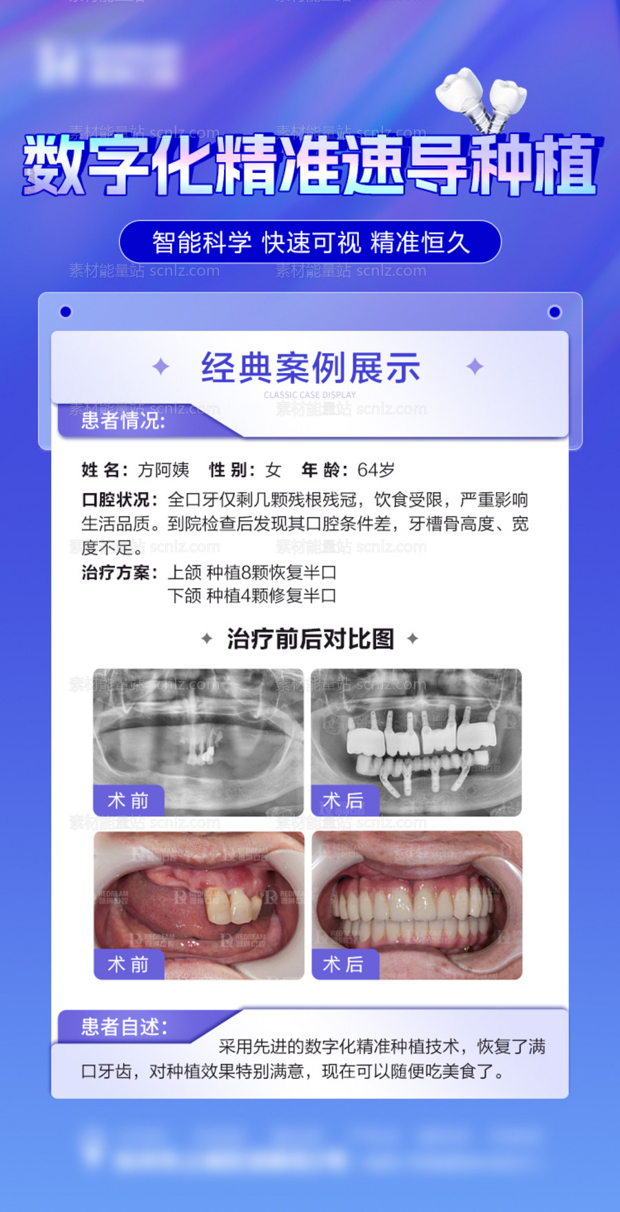 素材能量站-口腔案例家口腔海报