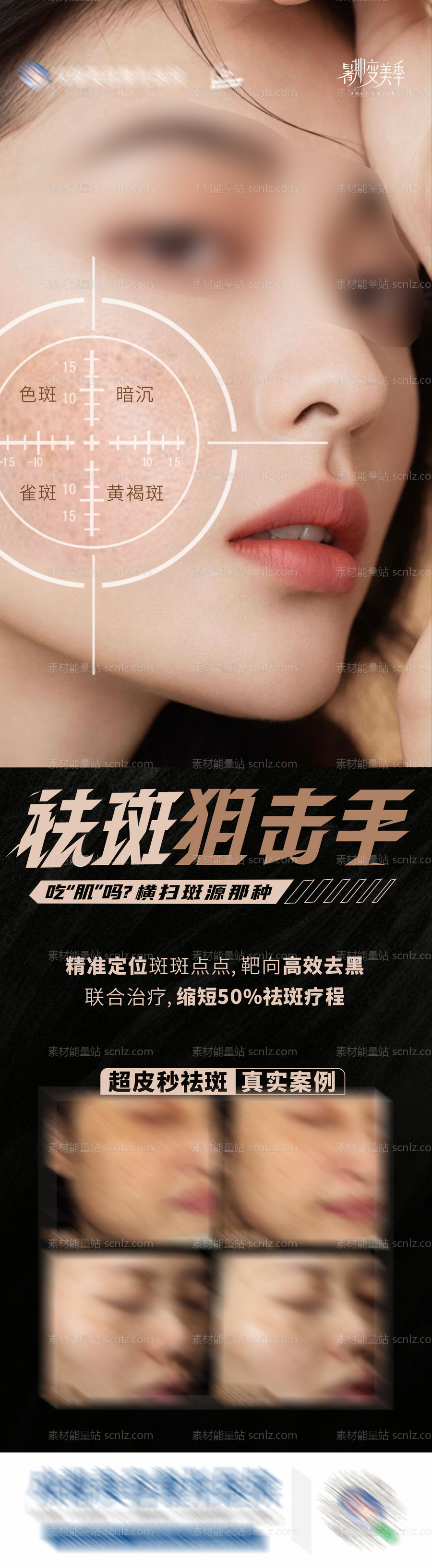 素材能量站-医美美业祛斑狙击手案例创意海报