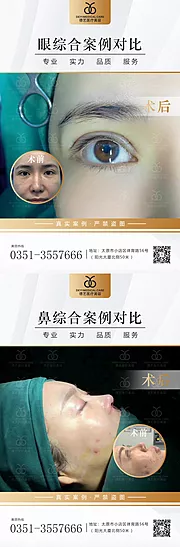 素材能量站-医美案例对比图