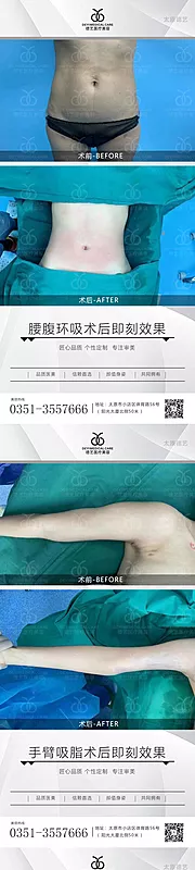 素材能量站-医美案例对比图