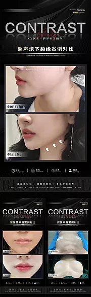 素材能量站-整形真人案例对比系列海报