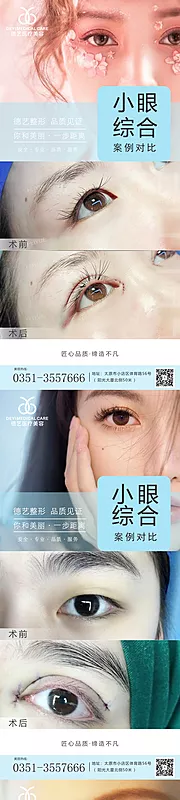 素材能量站-医美案例对比图