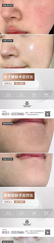 素材能量站-医美案例对比图