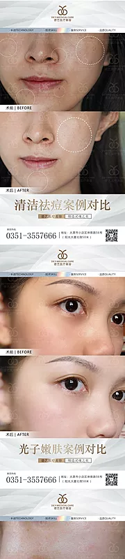 素材能量站-医美案例对比图