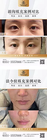 素材能量站-医美案例对比图