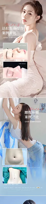 素材能量站-医美吸脂隆鼻案例海报