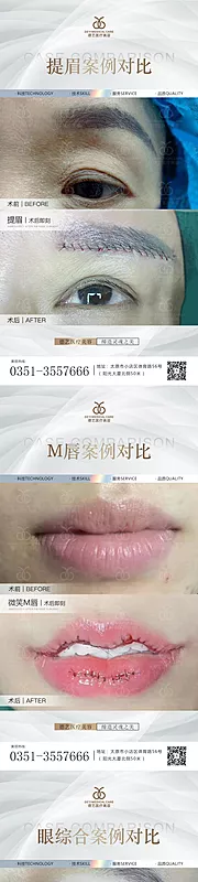 素材能量站-医美案例对比图