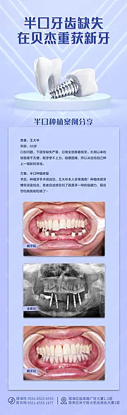 素材能量站-半口缺失案例