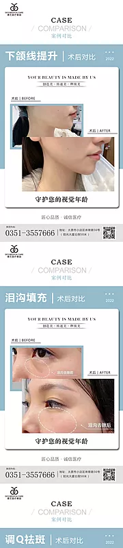 素材能量站-医美案例对比图