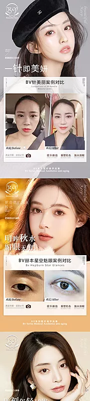 素材能量站-医美案例系列海报