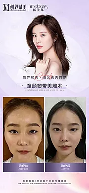 素材能量站-医美抗衰案例分享海报