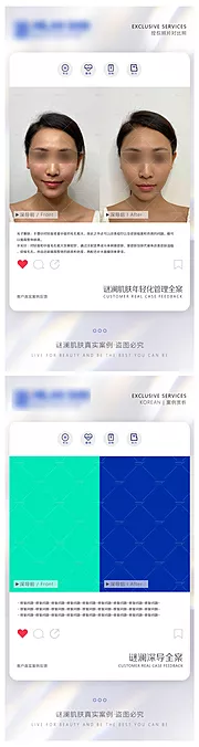 素材能量站-医美前后对比模板海报