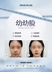 素材能量站-幼态脸对比图