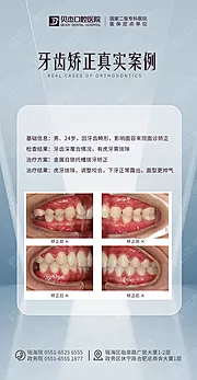 素材能量站-牙齿矫正案例