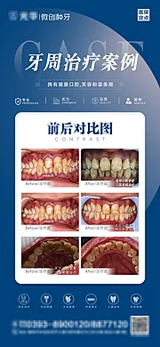 素材能量站-牙周案例对比图