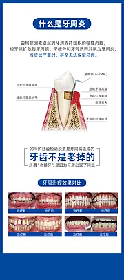 素材能量站-牙周炎易拉宝