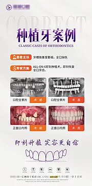 素材能量站-口腔种植牙案例对比海报